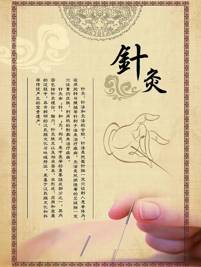 探究针灸疗法:中医古老智慧的现代应用